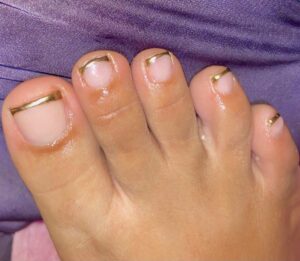 gel toes only